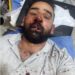 مقدم برامج في قناة البغدادية “علي الذبحاوي” يتعرض الى إعتداء وحشي من قبل مجهولين