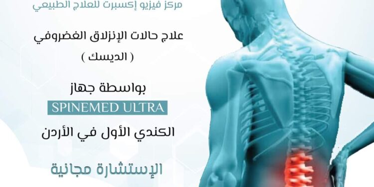 مركز فيزيو اكسبرت للعلاج الطبيعي يعرض اشهر جهاز طبي لعلاج الانزلاق الغضروفي “الديسك” دون تداخل جراحي