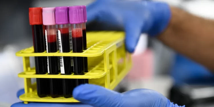 نقص حاد في أكياس الدم بليبيا.. وتوجه لاستيراده من مصر