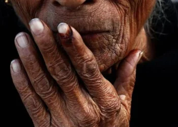 مكملات غذائية تؤخر شيخوخة الانسات لسنوات