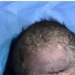 صور صادمة لولادة طفل بعين واحدة في العراق.. والطب يوضح