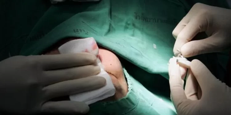 العراق .. عمليات “تجميل” بطعم الموت ونقابة الأطباء تحذر