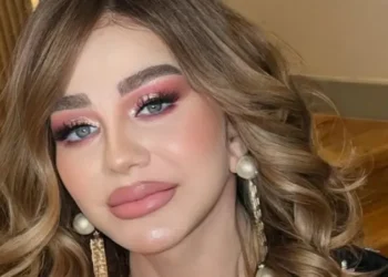 ميادة الحناوي تقلب مواقع التواصل بـ”وجه مشدود وشفاه ممتلئة”