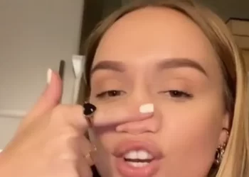 سحقت أنفها كلياً.. هولندية تثير ضجة على “تيك توك”